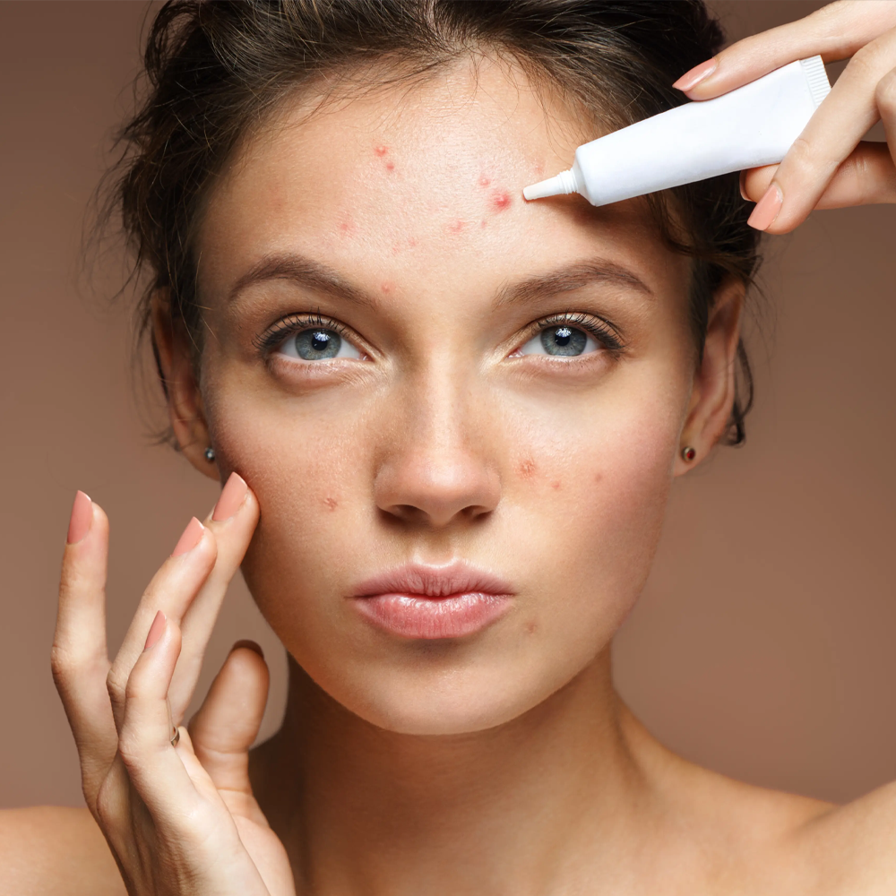 Mid Cosmetic - Chuyên phân phối dược mỹ phẩm chính hãng! 2 Tri mun